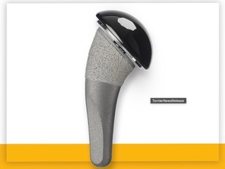 Pyrocarbon humeral head on a porous-coated stem, used for shoulder hemiarthroplasty
